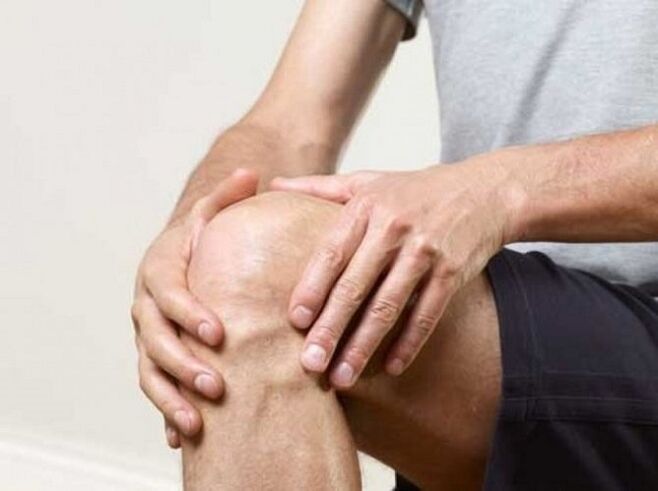 Kniewel mat Arthritis an Arthrosis